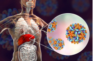 CORONAVIRUS Romania. Cifre dramatice: 2.844 de noi cazuri, la 8.709 teste efectuate in 24 de ore. S-au inregistrat 79 de decese, iar la ATI sunt 823 de pacienti internati