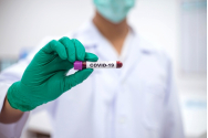 Testări gratuite în 600 de farmacii din Regiunea Romei