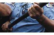 Tânără desfigurată de un polițist din Năvodari