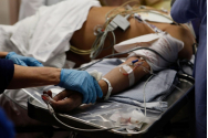 Bolnavii Covid-19 rămân cu sechele neurologice. Medic de la Institutul de Recuperare: 'Numărul lor a crescut semnificativ'