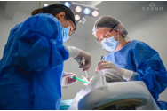Dinți Ficși în 24 de ore. Totul despre sistemul de implant dentar All-On-4/All-On-6 