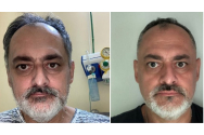 Povestea unui ieșean după ce a scăpat de COVID: A avut nevoie de un an de recuperare