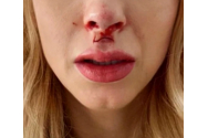 Andreea Bălan, operată de urgență. Va rămâne mutilată