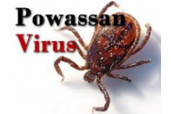 Virusul care ucide creierul. Boala este asimptomatică