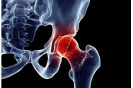 20 la sută dintre români au probleme cardiovasculare