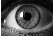 Operația care va schimba lumea: Medicii din Italia au făcut primul implant de retină artificială care redă vederea celor pe care să orbească