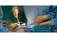 Un nou transplant de la soţie la soţ, în Iaşi