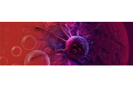 O femeie a făcut 12 tipuri de cancer