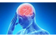 Sechelele după un accident vascular cerebral pot fi diminuate cu ajutorul inteligenței artificiale