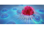 Cancerul, vindecat prin imunoterapie și inteligență artificială