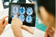Băutura care micșorează creierul! Poate cauza demență și atac cerebral