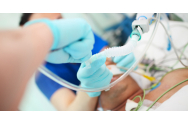 Pacientul operată de 7 ori de dr Tesloianu. Femeia crede că are un dispozitiv cardiac provenit de la un mort