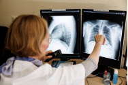Tuberculoza dă bătăi de cap medicilor ieșenui