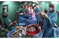 Încă două transplanturi renale, la „Parhon”
