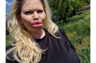 Femeia cu cele mai mari buze din lume și-a mărit și nasul. Pentru ce a făcut „experimentul” care i-a pus viaţa în pericol