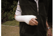 O bătrânică s-a apărat cu ghipsul de la mână împotriva fiului şi a nurorii
