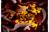 Fenomenul ia amploare - Alte două țări confirmă primele cazuri de persoane infectate cu coronavirus! Virusul ucigaș este acum prezent în 49 de țări