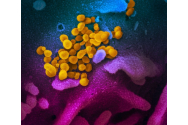 ALERTĂ Încă 4 cazuri de îmbolnăvire la Constanța! 68 de români infectați cu coronavirus