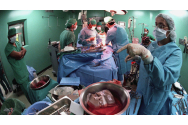 Transplant de ficat şi cornee, la Iaşi