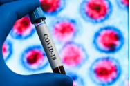 ALERTĂ FOCAR de coronavirus, la o fabrică cu 500 de angajați